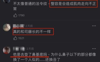 景甜整过容吗？景甜脸上惊现超深沟壑是动脸了吗？