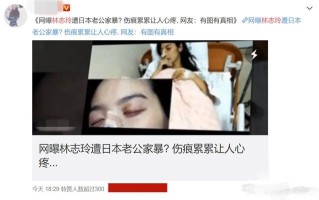 林志玲获老公做应援板 黑泽良平直呼:我的真爱