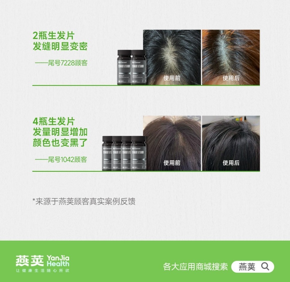 2 瓶见效,4 瓶惊艳,燕荚生发片效果反馈-第4张图片-芙蓉之城